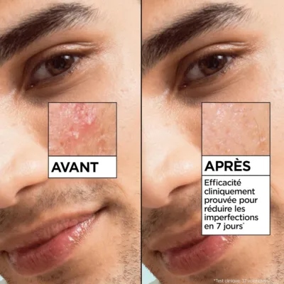 Garnier Serum anti imperfections - Atlas Santé parapharmacie Dakar — image 6